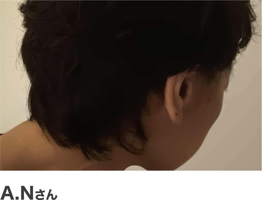 A.Nさん